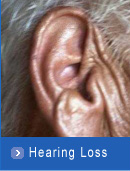 hearing difficulty